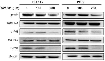 J Cancer Image