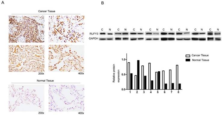 J Cancer Image