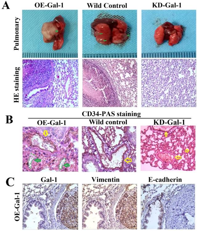 J Cancer Image