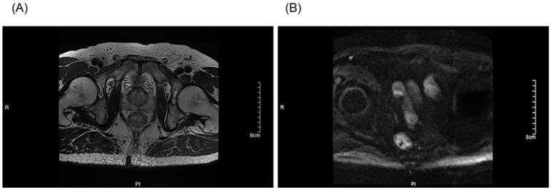 J Cancer Image