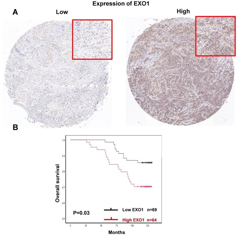 J Cancer Image