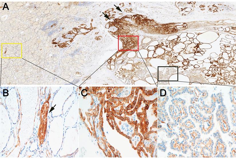 J Cancer Image