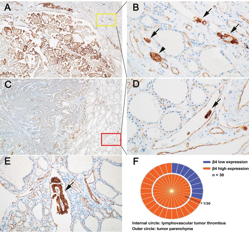 J Cancer Image