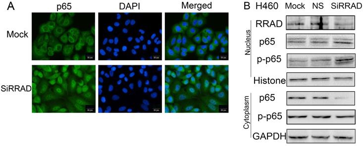 J Cancer Image