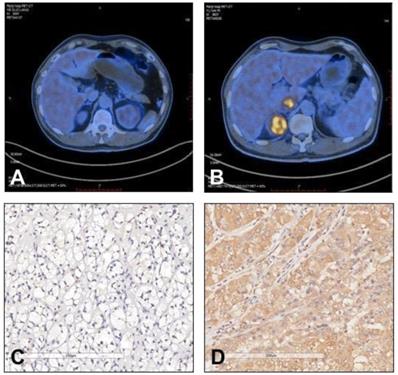 J Cancer Image