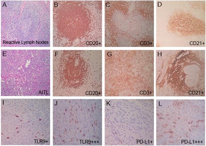 J Cancer Image