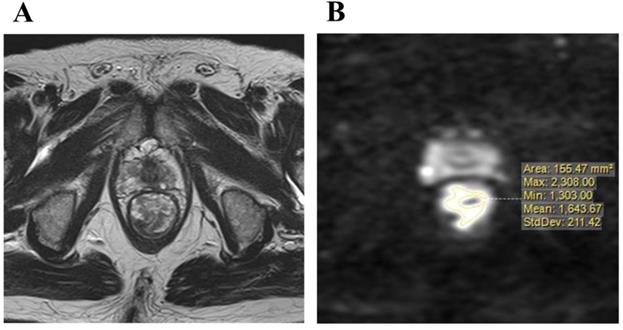 J Cancer Image