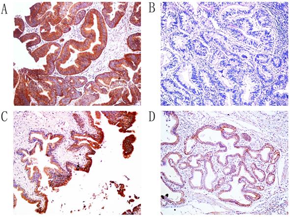 J Cancer Image