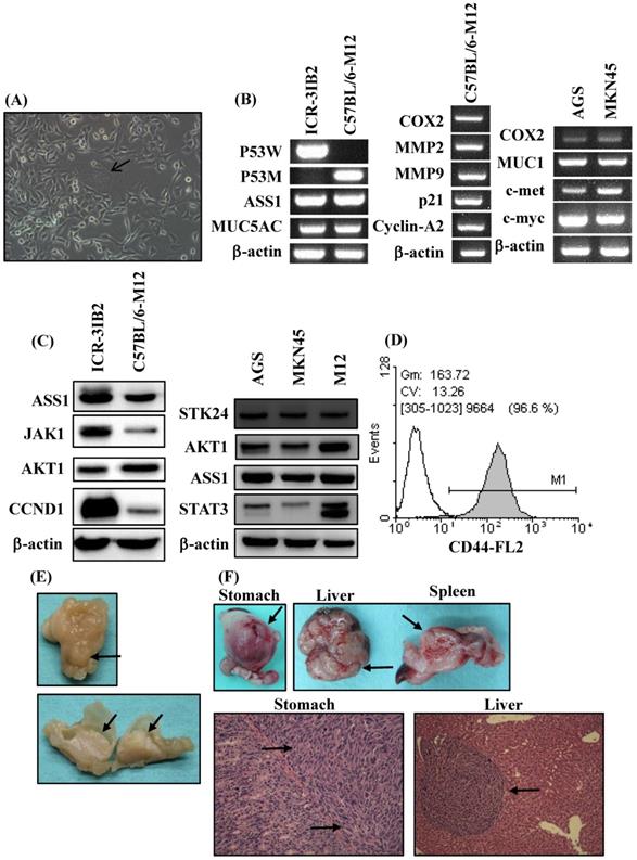 J Cancer Image