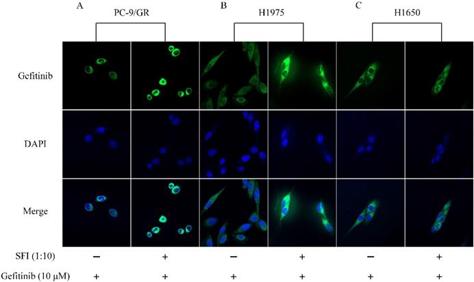 J Cancer Image