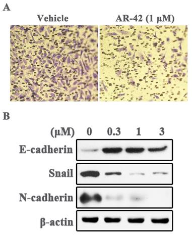 J Cancer Image