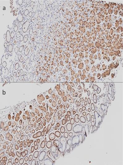 J Cancer Image