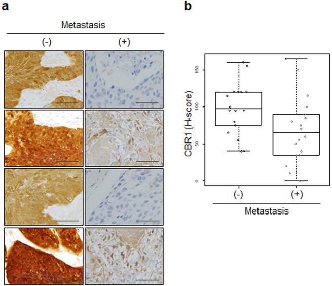 J Cancer Image