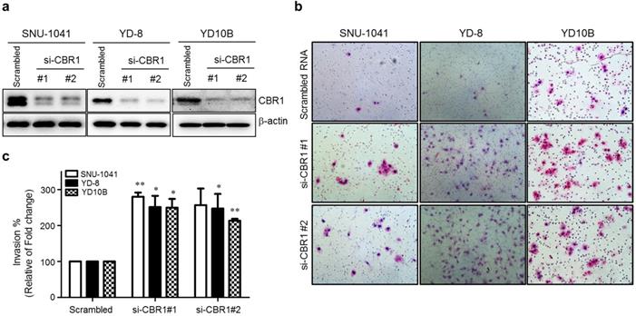 J Cancer Image