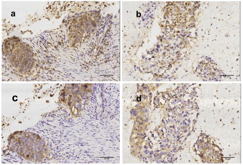 J Cancer Image