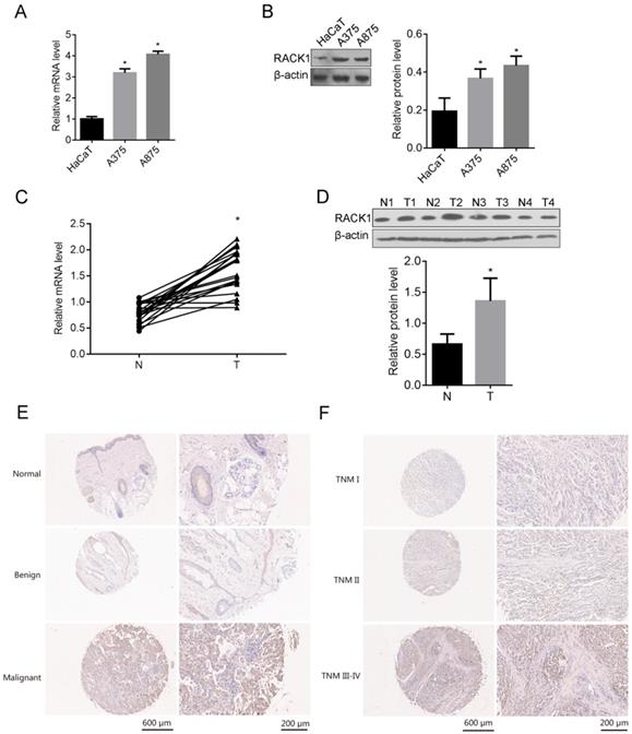 J Cancer Image