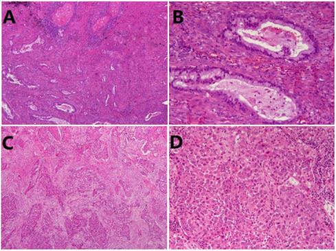 J Cancer Image