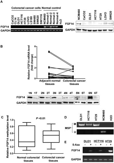 J Cancer Image