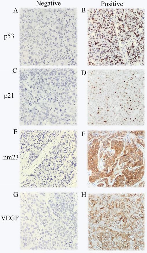 J Cancer Image