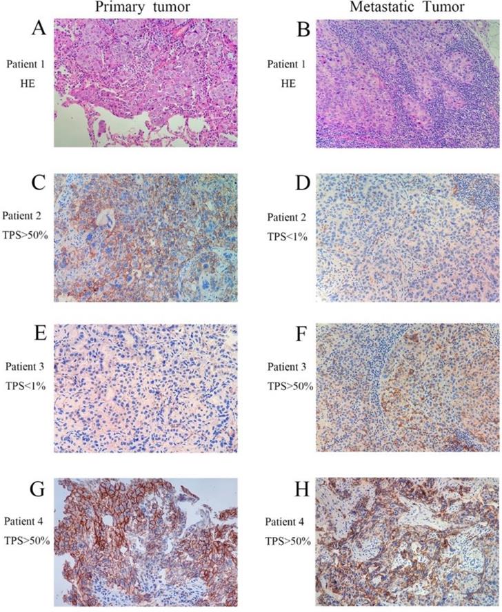 J Cancer Image