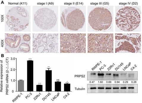 J Cancer Image