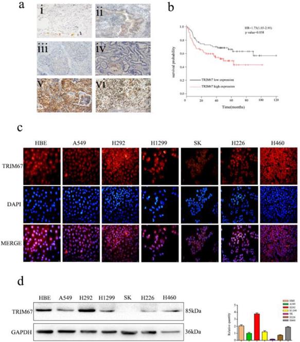 J Cancer Image