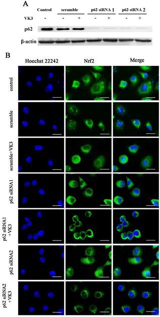 J Cancer Image