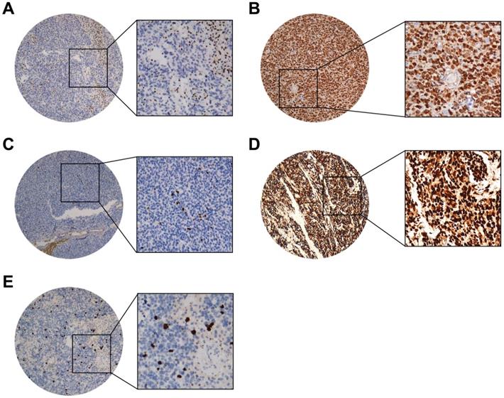 J Cancer Image