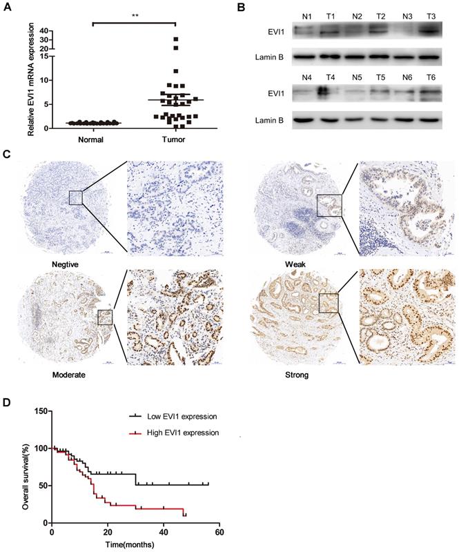 J Cancer Image