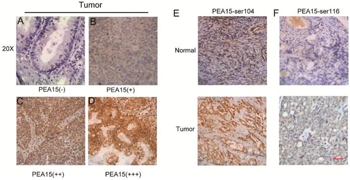 J Cancer Image