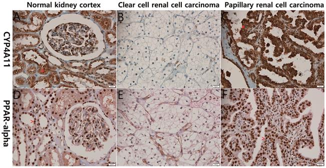 J Cancer Image