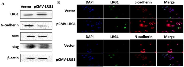 J Cancer Image