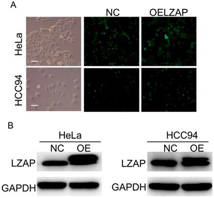 J Cancer Image