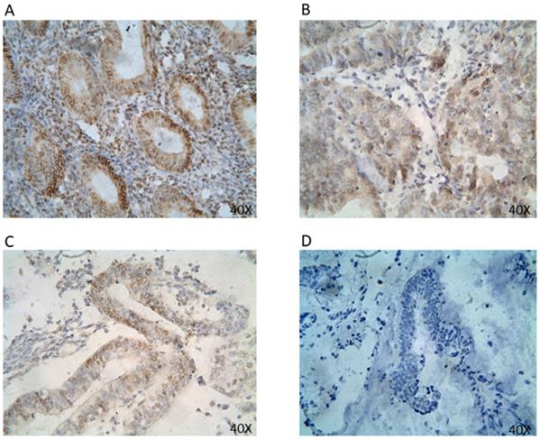 J Cancer Image