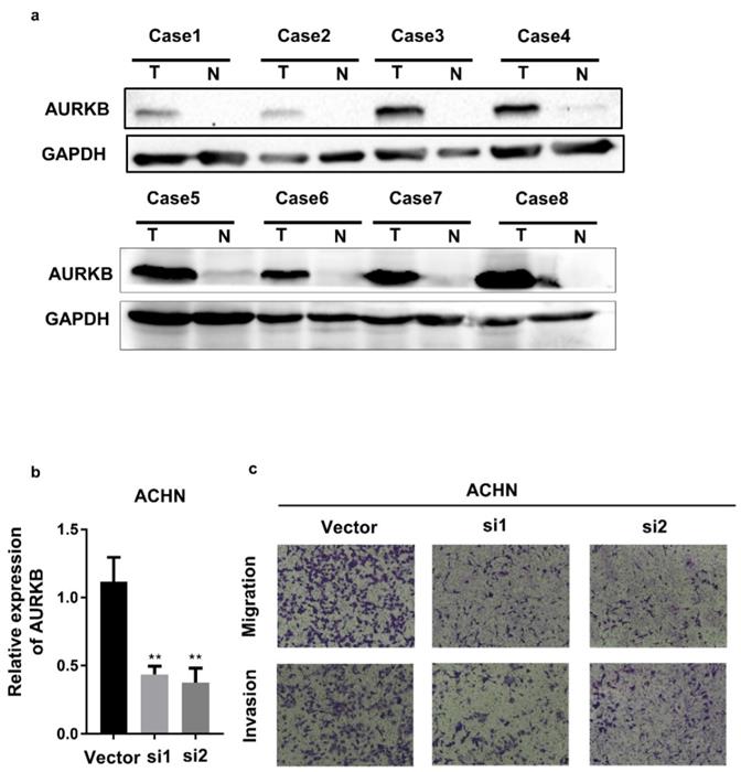 J Cancer Image