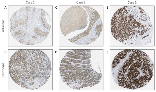 J Cancer Image