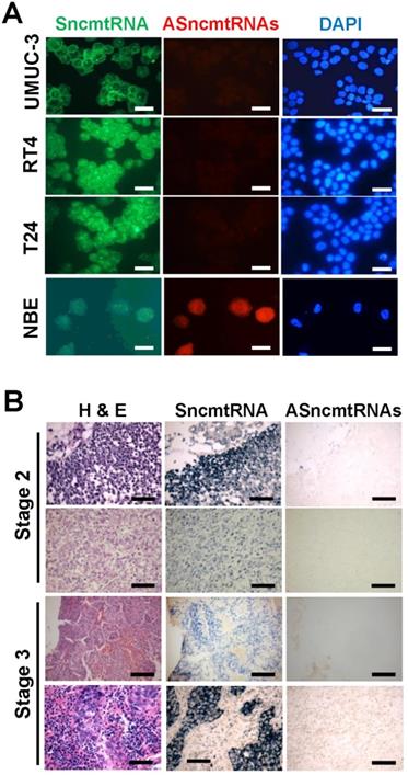 J Cancer Image