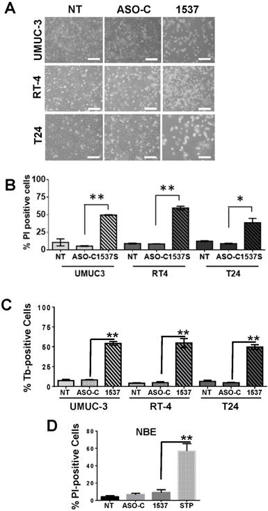 J Cancer Image