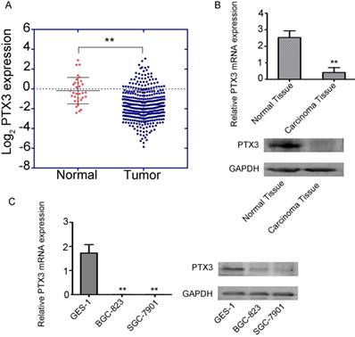 J Cancer Image