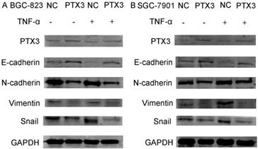 J Cancer Image