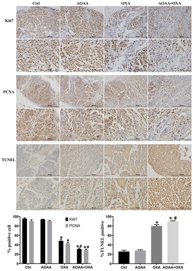 J Cancer Image