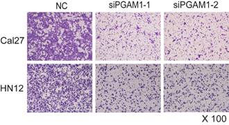 J Cancer Image