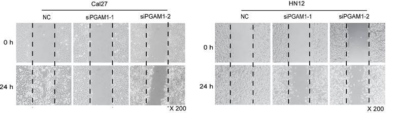 J Cancer Image