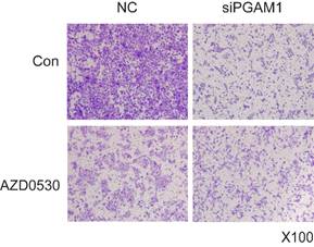 J Cancer Image