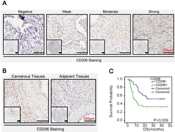 J Cancer Image