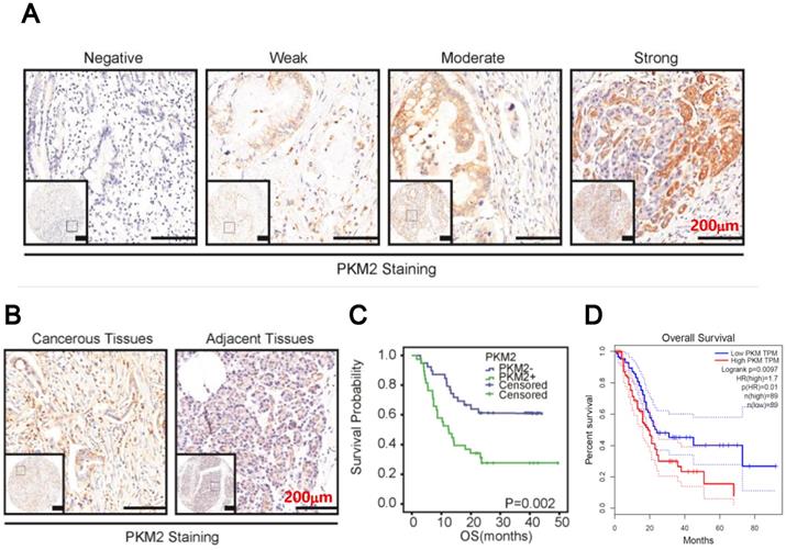 J Cancer Image