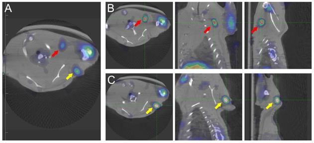 J Cancer Image