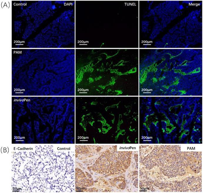 J Cancer Image