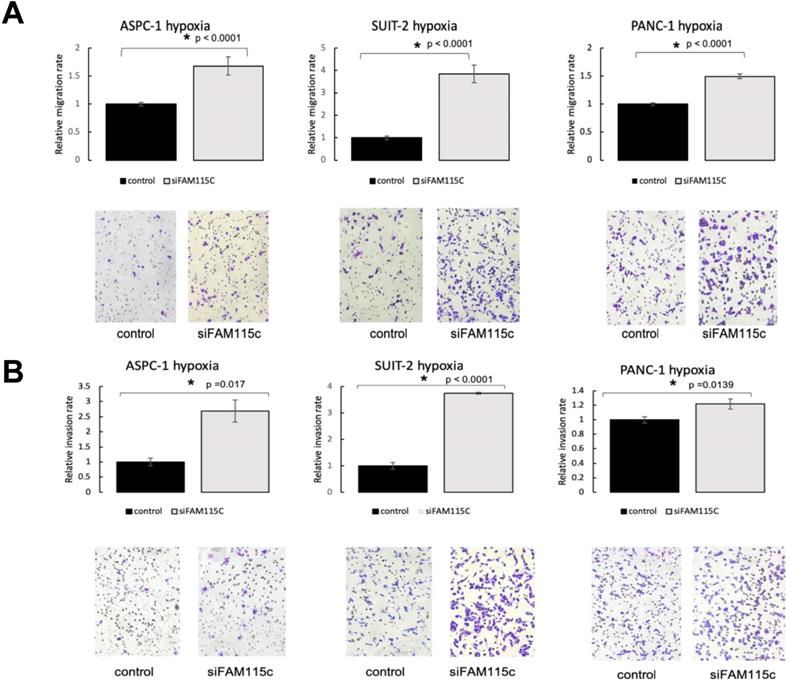 J Cancer Image