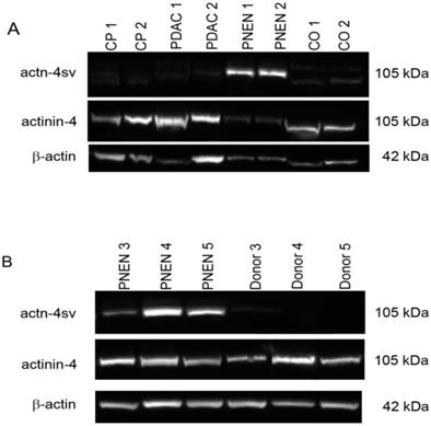 J Cancer Image